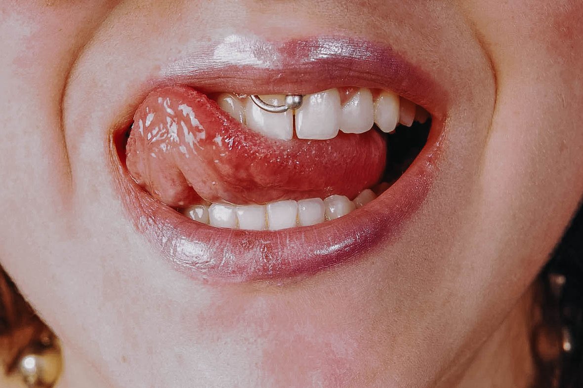 Smiley piercing