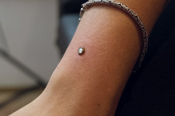 piercing mikrodermál