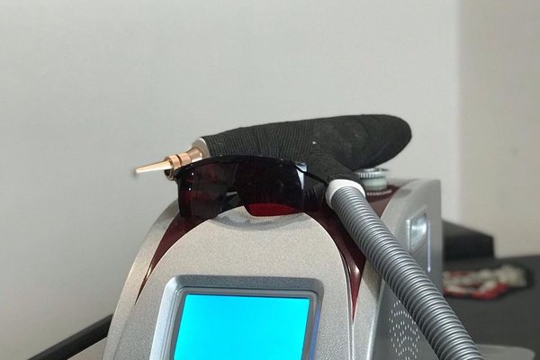Laserové odstranění permanentního make-upu v Brně