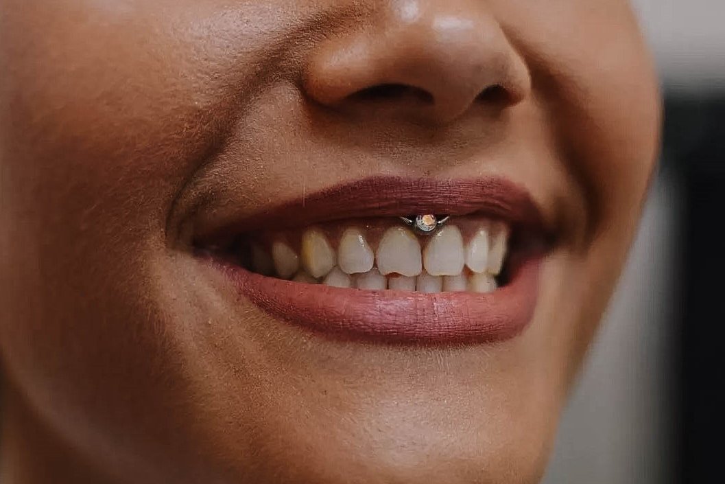Smiley piercing