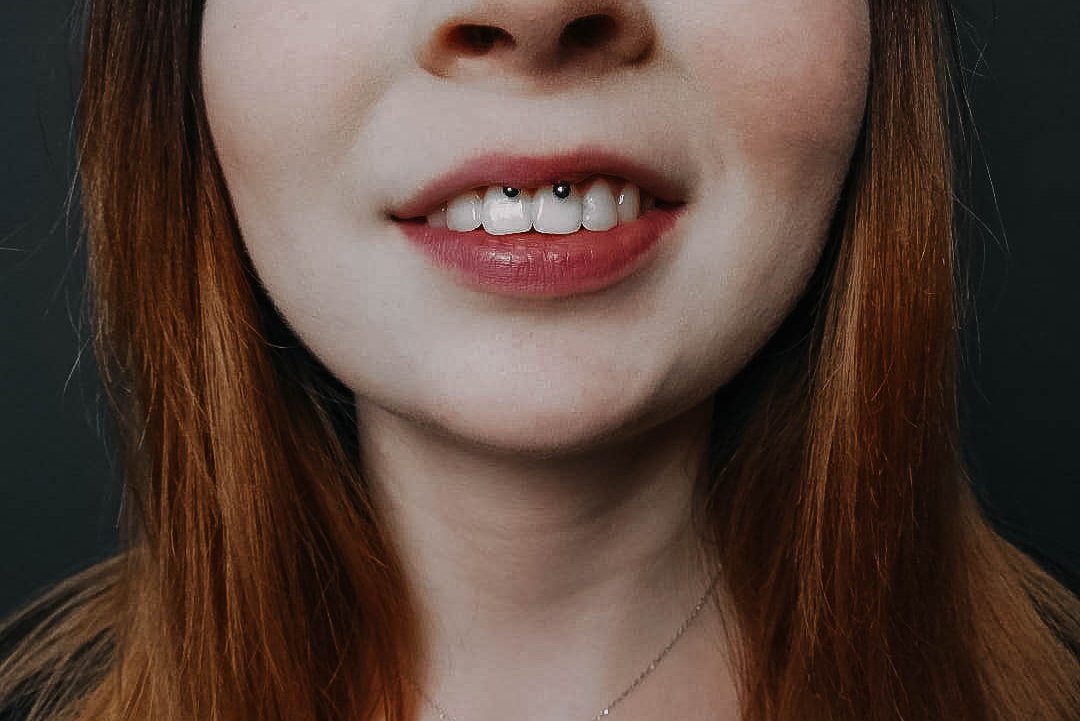 Smiley piercing